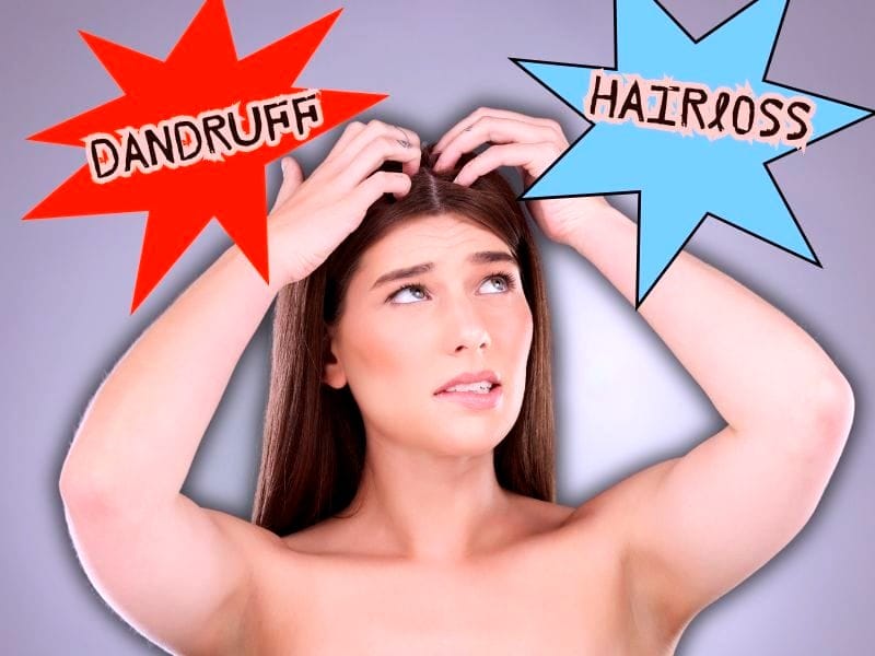 Concerned woman scratching her scalp, struggling with dandruff and hair loss issues, highlighting scalp health problems.