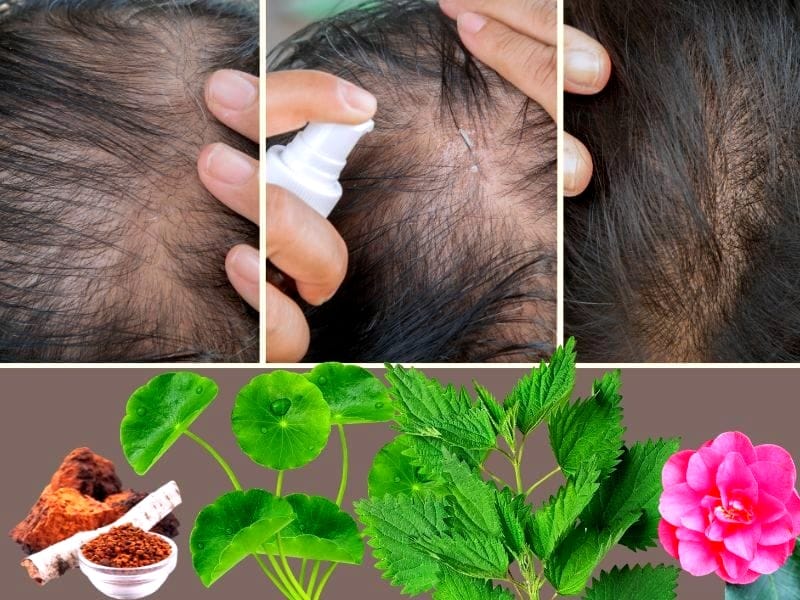 Scalp treatment with natural herbs promoting healthy hair growth, showing before and after improvement.